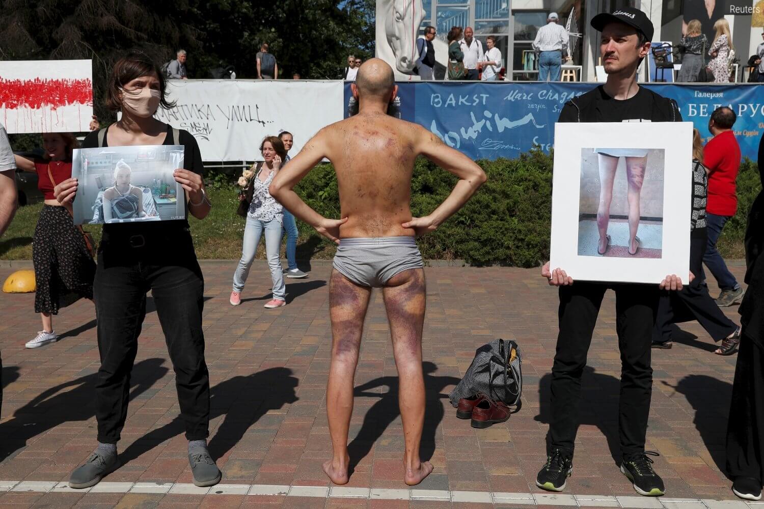 В Минске прошла массовая выставка фотографий травм,  которые нанесли силовики протестующим